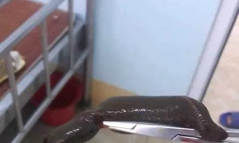 Bị đỉa dài 15cm chui vào dương vật