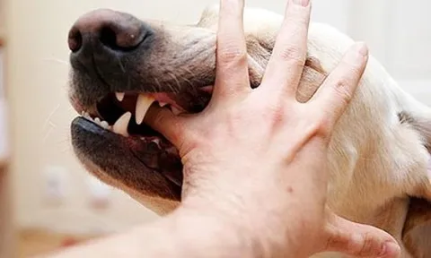 Người phụ nữ ở Vĩnh Phúc tử vong sau 3 tháng bị chó nhà cắn