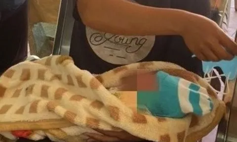 Vừa chào đời bé đã phải nhập viện khâu 21 mũi vì sai lầm của người lớn