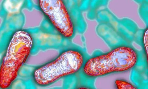 Phòng ngừa ngộ độc Botulinum như thế nào?