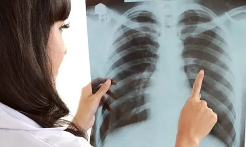 Nữ giáo viên sốc khi phát hiện mắc ung thư phổi, chia sẻ 3 dấu hiệu đã trải qua