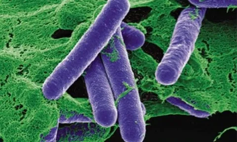 Vi khuẩn gây ngộ độc Botulinum tấn công cơ thể như thế nào?