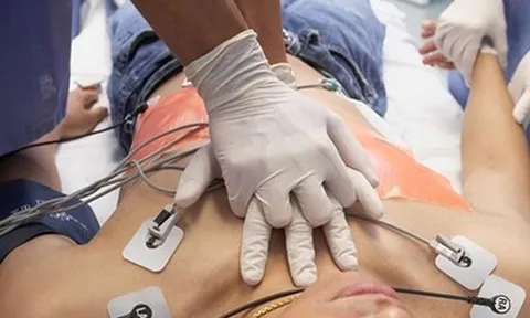 Sau cuộc nhậu, nam thanh niên đột ngột lên cơn nhồi máu cơ tim