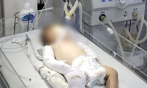 Sức khỏe bé gái 3 tháng tuổi ở Đà Lạt bị người tình của mẹ bạo hành giờ ra sao?