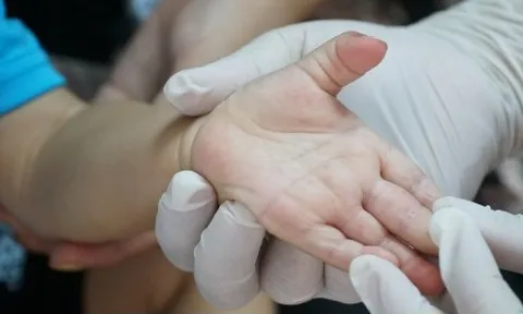 Một bệnh nhi ở Đắk Lắk tử vong vì tay chân miệng