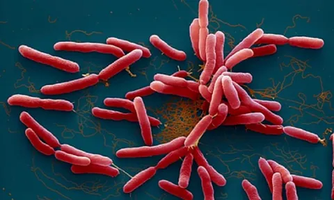 Đắk Lắk ghi nhận một bệnh nhi tử vong vì bệnh Whitmore