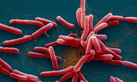 Bé 2 tuổi ở Đắk Lắk tử vong vì nhiễm vi khuẩn 'ăn thịt người' Whitmore