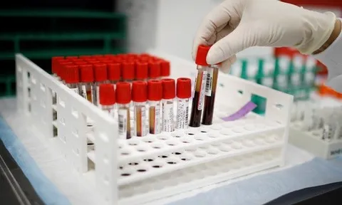 Hy vọng mới từ xét nghiệm ung thư đột phá