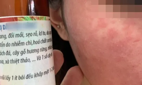 Mê làm đẹp bằng cách lột da, thiếu nữ Hà thành nhận kết đắng