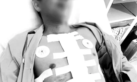 Ngoạn mục, các bác sĩ cứu sống người đàn ông vỡ tim