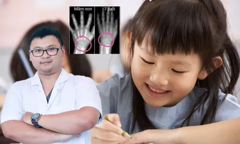 Cho trẻ tập viết quá sớm sẽ ảnh hưởng đến sự phát triển của xương: Bác sĩ chuyên khoa nói gì?