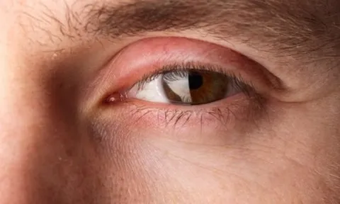 Đôi mắt nói gì về sức khỏe của bạn?