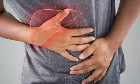 8 dấu hiệu cho thấy độc tố tích tụ quá nhiều trong gan