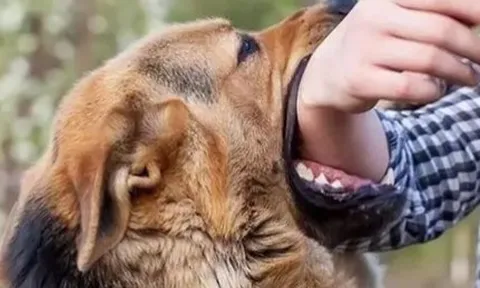 Người đàn ông tử vong sau hơn 4 tháng bị chó cắn