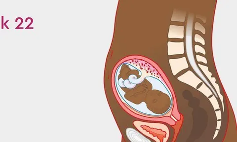 Nhập viện cấp cứu sau khi phá thai 22 tuần ở phòng khám tư