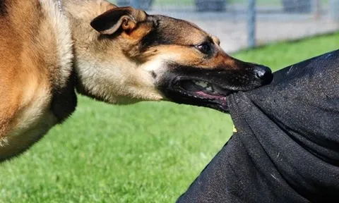 Hà Nội: Bé trai 3 tuổi bị chó lai nặng 40kg cắn đứt xương hàm