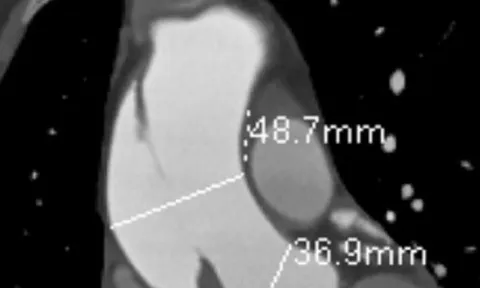 Đau ngực kéo dài, coi chừng đột tử