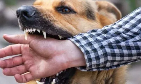 Đồng Nai: Điều tra dịch tễ, khoanh vùng sau khi 5 người bị chó dại cắn