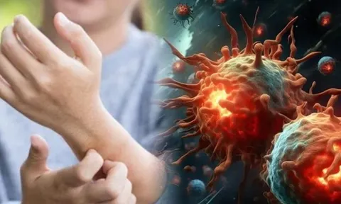 80% bệnh nhân ung thư tuyến tụy có chung '1 triệu chứng không ngờ tới'