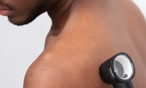 3 dấu hiệu xác định sớm căn bệnh ung thư da ở đàn ông