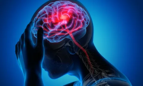 Sống sót sau khi bị đột quỵ ở tuổi 20, cô gái trẻ chỉ ra triệu chứng mà mình đã bỏ qua