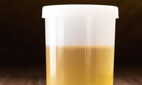 '3 vàng' trên cơ thể báo hiệu sức khoẻ bạn gặp vấn đề, cần gặp bác sĩ ngay