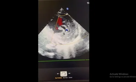 Bệnh viện Thủ Đức phát hiện ca bệnh hiếm gặp