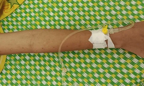 Trẻ tử vong vì người nhà rạch dao lam chi chít trên người để chữa bệnh