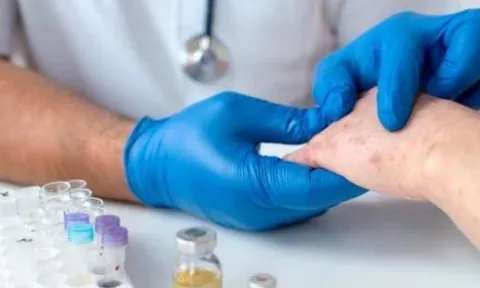 Bệnh phong lan rộng tại Mexico