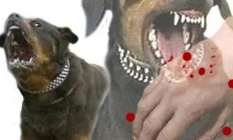 Đắk Nông: 1 trẻ tử vong do bệnh dại sau 40 ngày bị chó cắn