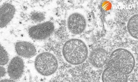 Thái Lan ghi nhận ca tử vong đầu tiên do đậu mùa khỉ