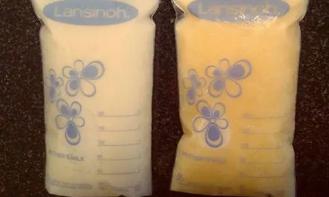 Sốc với bức ảnh về sự thay đổi kỳ diệu của sữa mẹ khi bé bị ốm