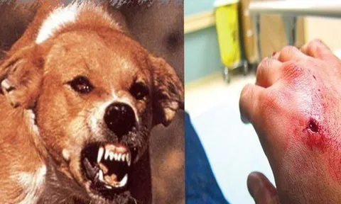 Người đàn ông ở Quảng Ngãi tử vong sau 2 tháng nghi bị chó dại cắn