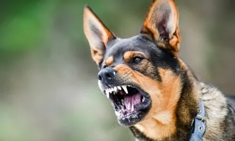 Bé trai 6 tuổi tử vong sau khi bị chó cắn vào gò má