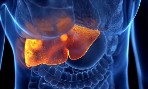 10 nguyên nhân không ngờ gây suy gan cấp: Số 3 nhiều người dễ mắc