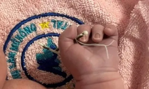 Câu chuyện phía sau hình ảnh em bé chào đời cầm vòng tránh thai trên tay