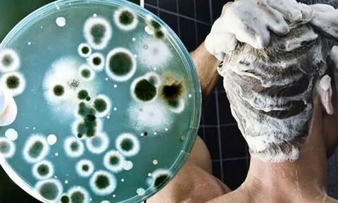 Bác sĩ cảnh báo: Không vệ sinh thứ này trong phòng tắm đúng cách có thể gây tổn thương da, phổi