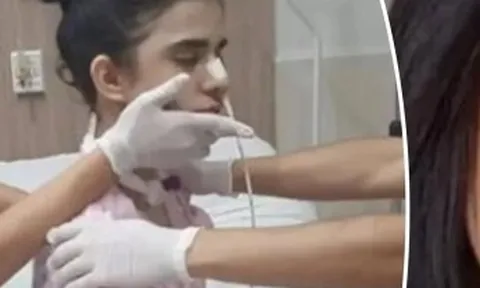 Hít phải ớt siêu cay, cô gái bị phù não, hôn mê nhiều ngày