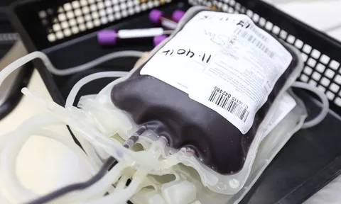 Viện Karolinska: Nguy cơ đột quỵ có thể bị “lây” qua truyền máu