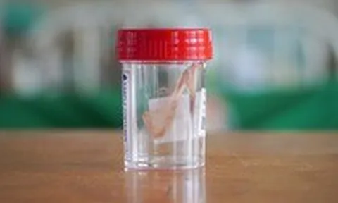 Nguy kịch vì tìm người "đẻ ngược" vuốt hóc xương