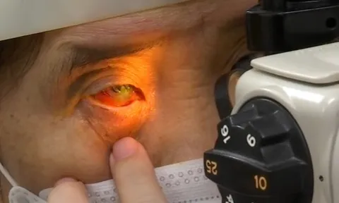 Có nên ngủ chung với người bị đau mắt đỏ?