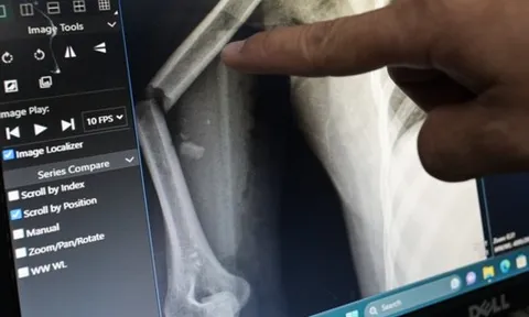 Người phụ nữ nhảy xuống từ tầng 9 chung cư mini trải qua 2 lần phẫu thuật