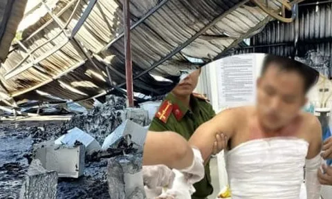 Chiến sỹ PCCC bị bỏng nặng khi chữa cháy ở Ninh Thuận