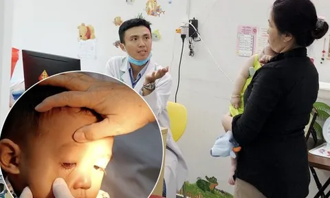 Bác sĩ: Cần phân biệt đau mắt đỏ do virus hay vi khuẩn, có các triệu chứng sau phải đi khám ngay