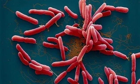 Thanh Hóa: Bệnh nhi mắc bệnh Whitmore tử vong