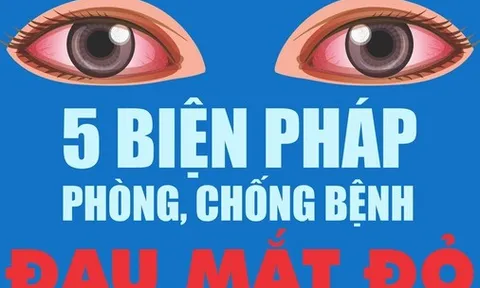 Infographic: 5 biện pháp phòng, chống bệnh đau mắt đỏ