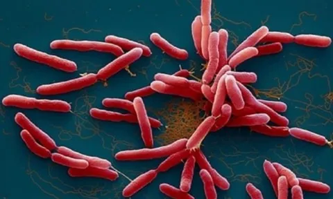 Cô gái 15 tuổi tử vong vì căn bệnh hiếm người mắc phải