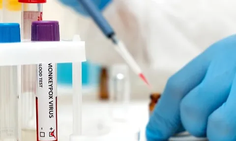 Dấu hiệu sớm nhận biết bệnh đậu mùa khỉ