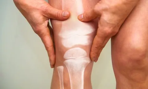 6 dấu hiệu trên cơ thể cảnh báo ung thư xương đã “gõ cửa”: Người trẻ càng phải đề phòng