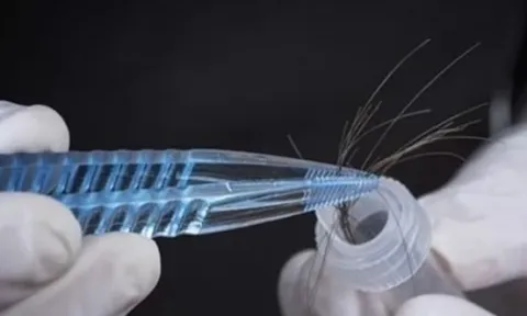 Đi xét nghiệm ADN, ông bố tá hoả phát hiện giới tính thật của con